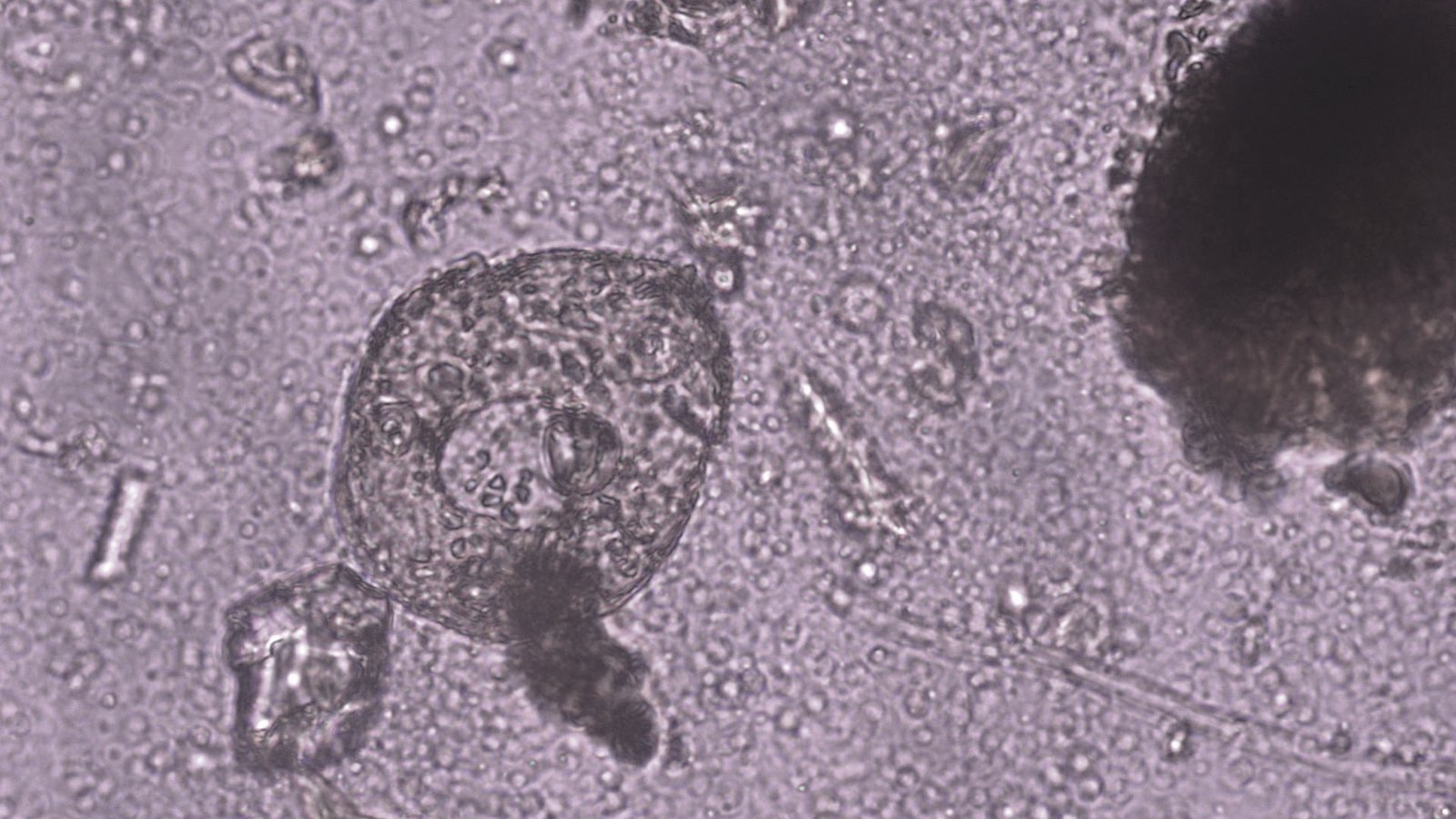 Protozoa bacteria and fungi